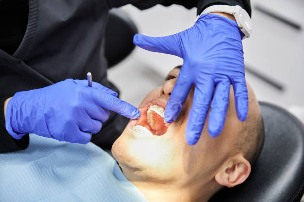 Best Broken or Cracked Tooth Emergency Dentist in Lake Ozark, MO